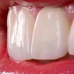 ThoroughDent Smiles - Beautiful smile makeover!