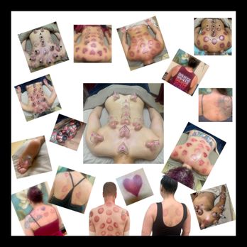 Mind Body & Massage Spa - Cupping Therapy - Day Spas Near Me - Fresno, California Mind Body & Massage Spa - Cupping Therapy - Day Spas Near Me - Fresno, California