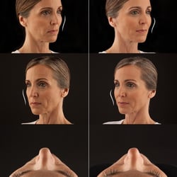 Image Rx - Voluma