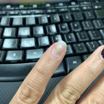 LA Nails Spa - Fungus on my nail - Nail Salons Near Me - Los Angeles, California