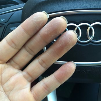 Ellen's Nails Shop - Super dry fingertips from soaking - Nail Salons Near Me - Atlanta, Georgia Ellen's Nails Shop - Super dry fingertips from soaking - Nail Salons Near Me - Atlanta, Georgia