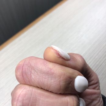 My Nails & Spa - My nails are literally filed all the way down to the base. - Nail Salons Near Me - Aurora, Colorado