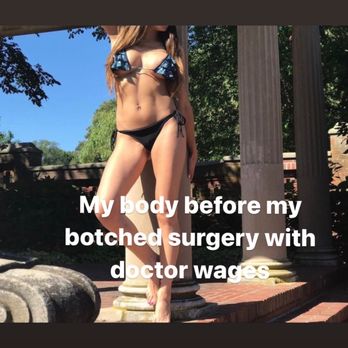 North Shore Plastic Surgery & Med Spa - My body before my botched surgery with doctor wages - Cosmetic Surgeons Near Me - Peabody, Massachusetts North Shore Plastic Surgery & Med Spa - My body before my botched surgery with doctor wages - Cosmetic Surgeons Near Me - Peabody, Massachusetts
