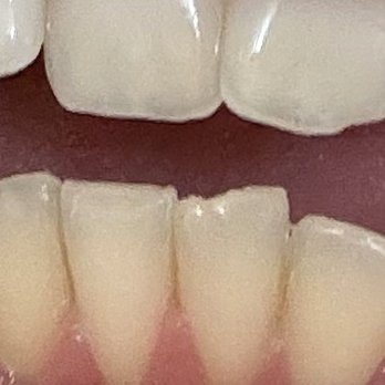 Saddleback Dental Associates - General Dentistry Near Me - Mission Viejo, California Saddleback Dental Associates - General Dentistry Near Me - Mission Viejo, California