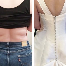 Lipo Massages of South Florida - Get your body ready for a wedding or other special occasion.