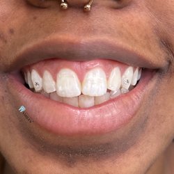 Official Pro Smiles - Tooth gems placed in chandler Arizona by officials pro smiles. Tooth gem training available by appointment only.