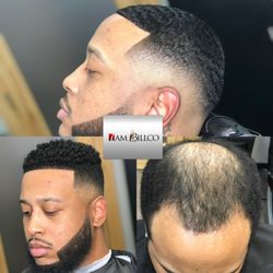 I Am Billco Hair Replacement Center - Non-Surgical Hair Loss Soultions.