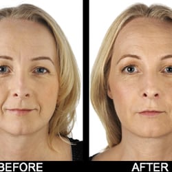 Derma Medical Laser Clinic - Skin Rejuvenation