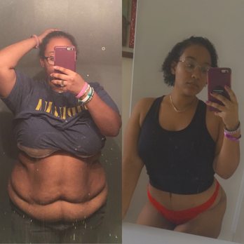 Spectrum Aesthetics - I have a waist! - Medical Spas Near Me - Miami, Florida