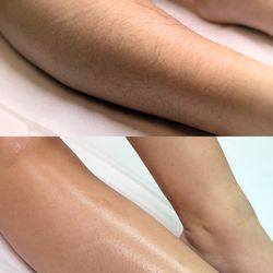 Uni K Wax Frisco - Lower Legs service before and after.