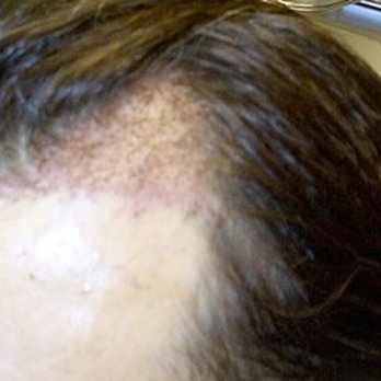 Jae Pak, M.D - Hair Loss Centers Near Me - Los Angeles, California