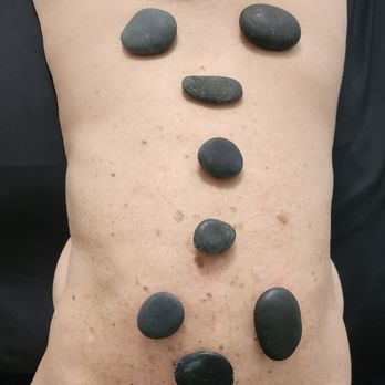 Lili Heissenbuttel - Hot Rocks treatment - Acupuncture Near Me - Key Largo, Florida Lili Heissenbuttel - Hot Rocks treatment - Acupuncture Near Me - Key Largo, Florida