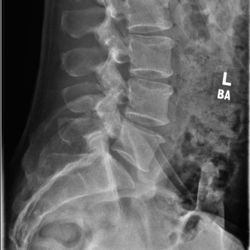 Kern Radiology | Downtown - My spine, checking the lumbar and the nerves.