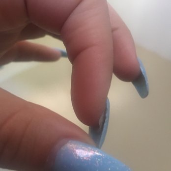 Nails U Love - Nail extremely lifted after 6 days. - Skin Care Near Me - Long Beach, California Nails U Love - Nail extremely lifted after 6 days. - Skin Care Near Me - Long Beach, California