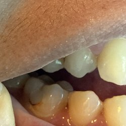 Affordable Dental at Ann & Willis