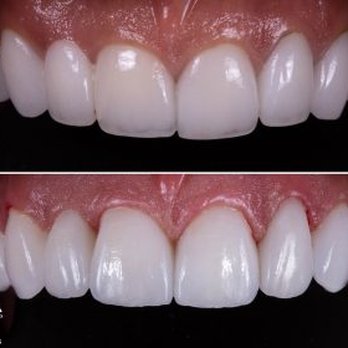 Pinewood Dentistry - Dentists Near Me - Cumming, Georgia