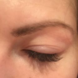 Noir Lash Lounge - Swollen eyelid 2 days after service.