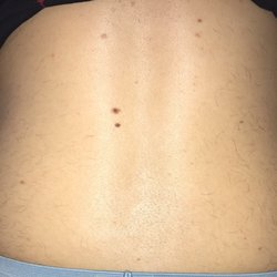 Ideal Image Strongsville