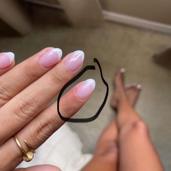 Oviedo Nails Spa - Cuticles are inflamed all over - Nail Salons Near Me - Winter Springs, Florida Oviedo Nails Spa - Cuticles are inflamed all over - Nail Salons Near Me - Winter Springs, Florida