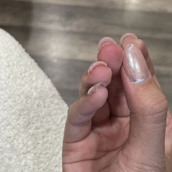 Glossi Nail Bar - Poor Gel X application, lifting & glue not applied and pressed! There is a gap between the tips and my natural nail. - Nail Salons Near Me - Colma, California