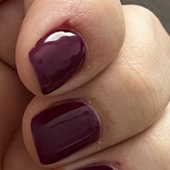 TJ Nails - My finger swollen with the cut - Nail Salons Near Me - Whittier, California