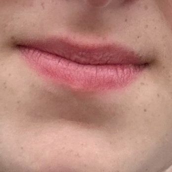 Garrett R Kawata, DDS - This is how she smiles now after two years of braces bc she feels embarrassed. - Orthodontists Near Me - Corona, California Garrett R Kawata, DDS - This is how she smiles now after two years of braces bc she feels embarrassed. - Orthodontists Near Me - Corona, California