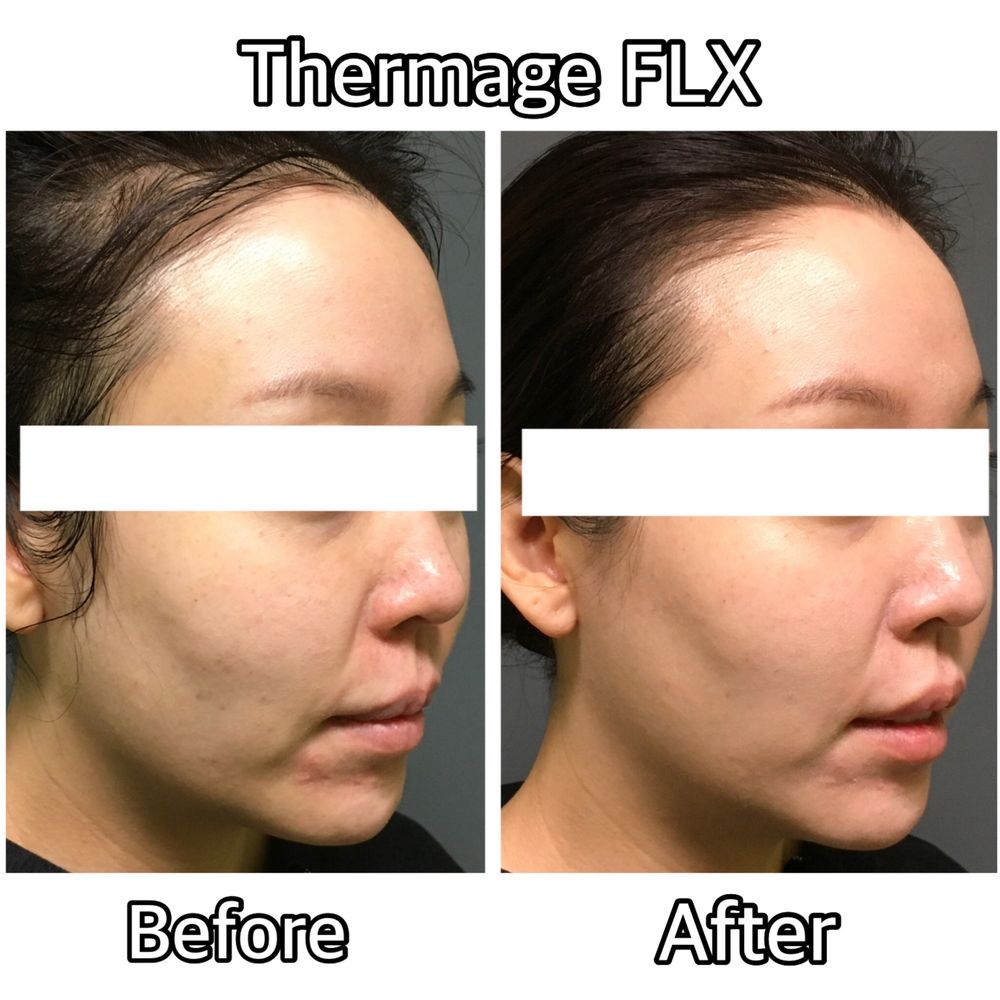 TOP 10 BEST Glutathione Injection in Orange County, CA - Updated 2026 - Quality & Affordability