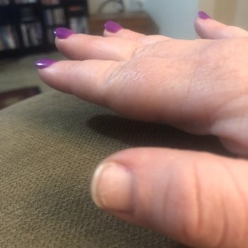 Enjoy Nails & Spa - Thumb after the dip & tip came off it a WEEK after my manicure. So 3 of my 10 nails didn't survive a week. - Nail Salons Near Me - Austin, Texas Enjoy Nails & Spa - Thumb after the dip & tip came off it a WEEK after my manicure. So 3 of my 10 nails didn't survive a week. - Nail Salons Near Me - Austin, Texas