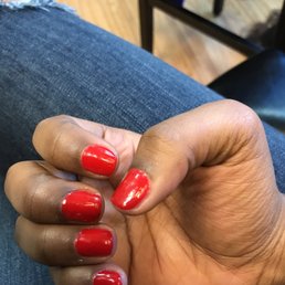 You can see lines in the finger nails