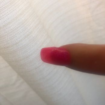 Ulux Nail Spa - Bumps in nails - Nail Salons Near Me - Dallas, Texas Ulux Nail Spa - Bumps in nails - Nail Salons Near Me - Dallas, Texas