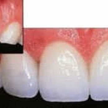 David Abri, DDS - General Dentistry Near Me - Los Angeles, California David Abri, DDS - General Dentistry Near Me - Los Angeles, California