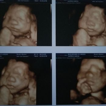 Womb's View - I can't stop staring at these pictures. They did an amazing job getting clear ones. - Ultrasound Imaging Centers Near Me - Modesto, California