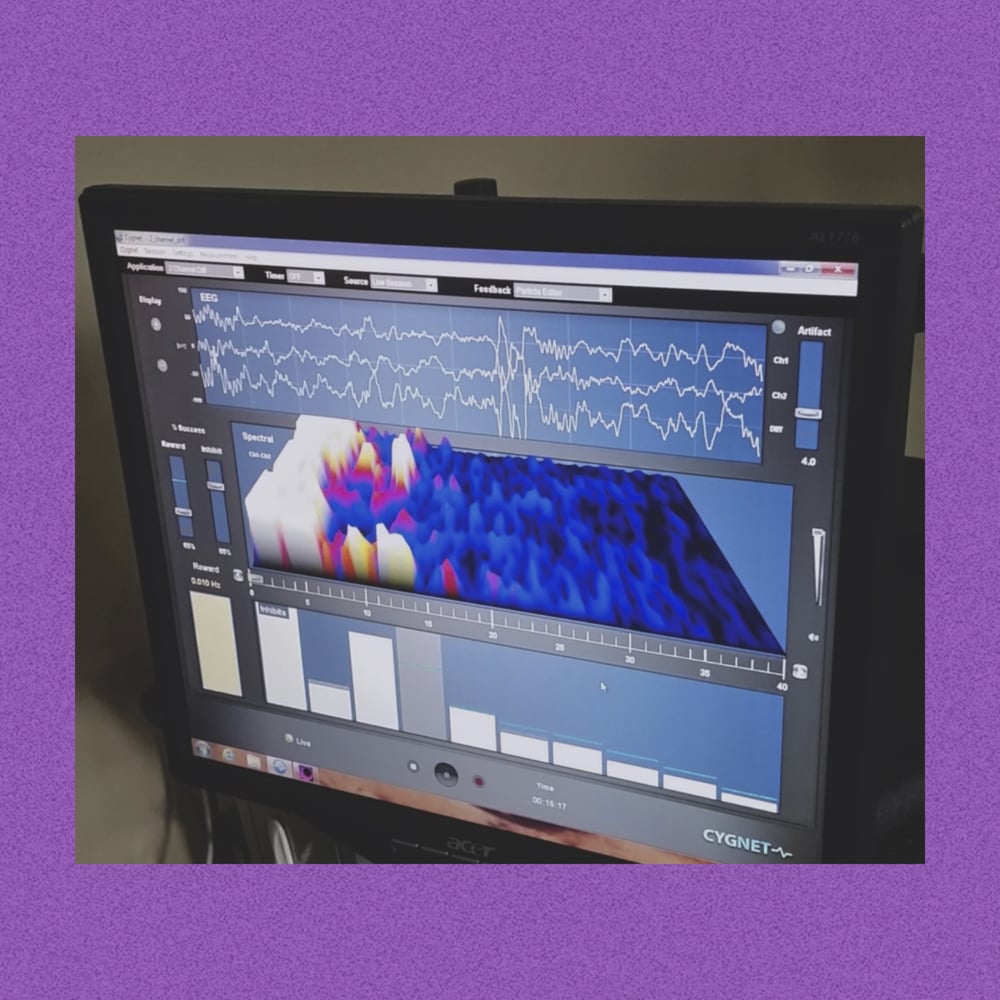 Brain Boosters Centers For Success - sleep specialist in Upland, CA