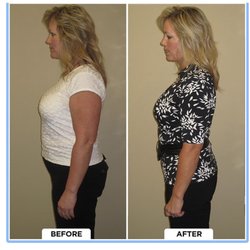 Health by Design Natural Clinic - We help you lose inches through red light therapy.
