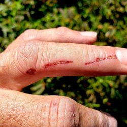 Yosemite Beads R Us - Serious injury. The owner didn't even care.