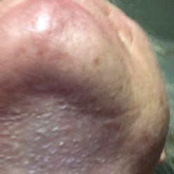 Colorado Springs Dermatology
