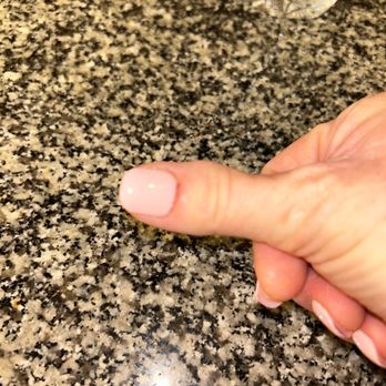 Lily's Nail & Spa # 2 - Right hand thumb - redness and pain at the cuticle. - Nail Salons Near Me - Carlsbad, New Mexico Lily's Nail & Spa # 2 - Right hand thumb - redness and pain at the cuticle. - Nail Salons Near Me - Carlsbad, New Mexico