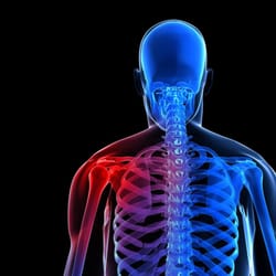 DFP Ortho - Centerpoint - Shoulder Orthopedic Specialist in Independence