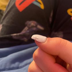 Uptown Nails - The chipped polish on my thumb nail.