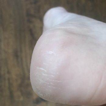 Harmony Nails - My heels AFTER a supposed pedicure. - Nail Salons Near Me - Conifer, Colorado