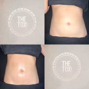 The Tox - Massage Near Me - Alamo, California