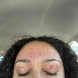 They butchered my face. 2 days before my birthday! The eyebrows don't even look good!