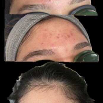 Bare Skin - Skin Care Near Me - Paso Robles, California