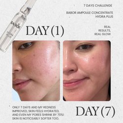 Esthetics by Roxanne