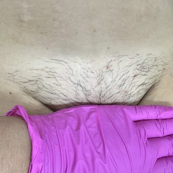Fab Bare Skin Studio - Before a brazilian - Waxing Near Me - Sacramento, California Fab Bare Skin Studio - Before a brazilian - Waxing Near Me - Sacramento, California