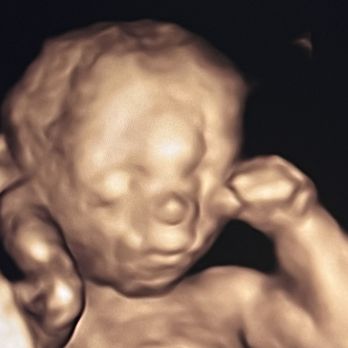 Torbati Kamran, MD, FACOG - Obstetricians & Gynecologists Near Me - Tarzana, California Torbati Kamran, MD, FACOG - Obstetricians & Gynecologists Near Me - Tarzana, California