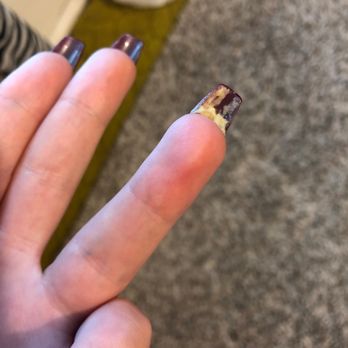 Dynamic Nails & Spa - Nail that broke that I super glued to keep intact until prom - Waxing Near Me - Emporia, Kansas