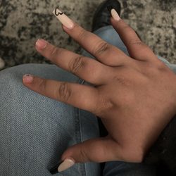 Popped off nails
