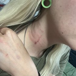 Snappers - Physical harm.