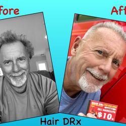 Hair DRx - A sampling of the miracle transition...